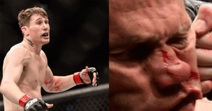 Donald Cerrone got his nose broken when he was knocked out the in first round by Darren Till at UFC Fight Nigh 118 from Poland.