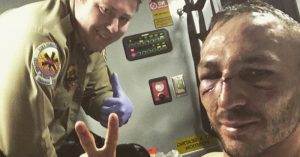 UFC lightweights Lando Vannata and Bobby Green went to war for 3 rounds at UFC 216, and the aftermath has Vannata paying the hospital a visit.