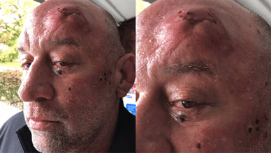 UFC Hall of Fame member Mark Coleman was beat up in a street fight.