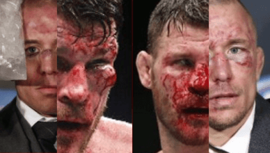 A side-by-side comparison of what UFC middleweight champion Michael Bisping and former welterweight champ GSP have looked like after wars in the octagon.