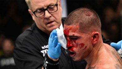 A very bloody former UFC lightweight champion Anthony Pettis at UFC Fight Night 120.