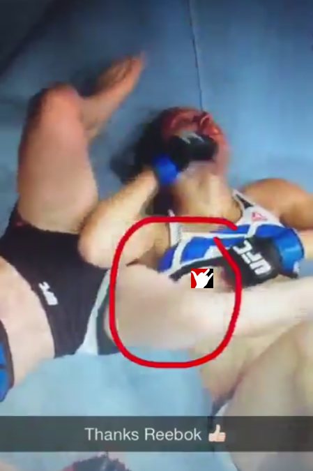 Check out some of the most embarrassing UFC wardrobe malfunction in mixed m...